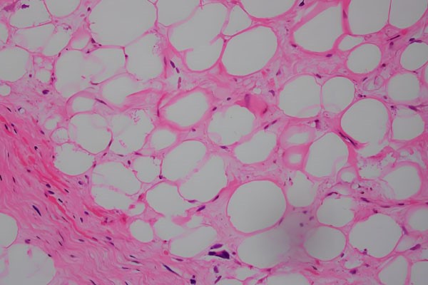 5-Amino-1MQ Cost| Shaanxi BLOOM Tech Co., Ltd 5-Amino-1MQ Cost| Shaanxi BLOOM Tech Co., Ltd