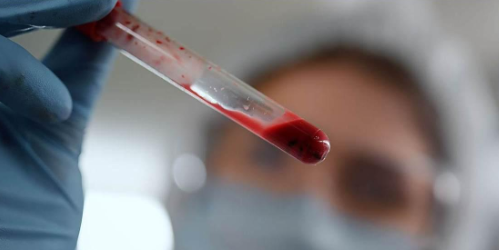 5-Amino-1MQ Specificity of NNMT Targeting | Shaanxi BLOOM Tech Co., Ltd 5-Amino-1MQ Specificity of NNMT Targeting | Shaanxi BLOOM Tech Co., Ltd