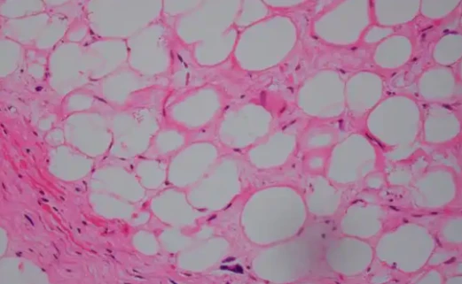 5-Amino-1MQ Adaptive Thermogenesis | Shaanxi BLOOM Tech Co., Ltd 5-Amino-1MQ Adaptive Thermogenesis | Shaanxi BLOOM Tech Co., Ltd