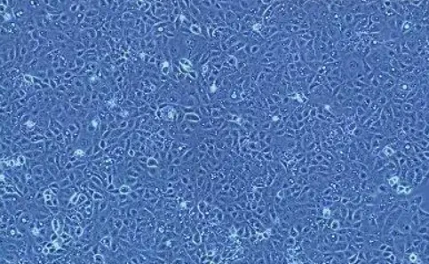 5-Amino-1MQ Metabolic Enzyme Function | Shaanxi BLOOM Tech Co., Ltd 5-Amino-1MQ Metabolic Enzyme Function | Shaanxi BLOOM Tech Co., Ltd