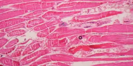 5-Amino-1MQ Muscle tissue | Shaanxi BLOOM Tech Co., Ltd