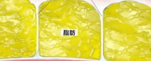 5-Amino-1MQ Dark and beige fat tissue | Shaanxi BLOOM Tech Co., Ltd