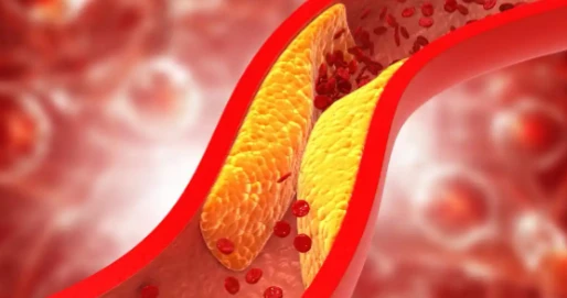 Bioglutide NA-931 Cardiovascular Risk Factor Improvements | Shaanxi BLOOM Tech Co., Ltd Bioglutide NA-931 Cardiovascular Risk Factor Improvements | Shaanxi BLOOM Tech Co., Ltd