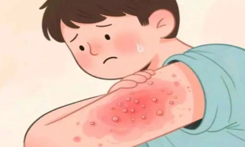 Sermorelin Cost | Shaanxi BLOOM Tech Co., Ltd Sermorelin Cost | Shaanxi BLOOM Tech Co., Ltd