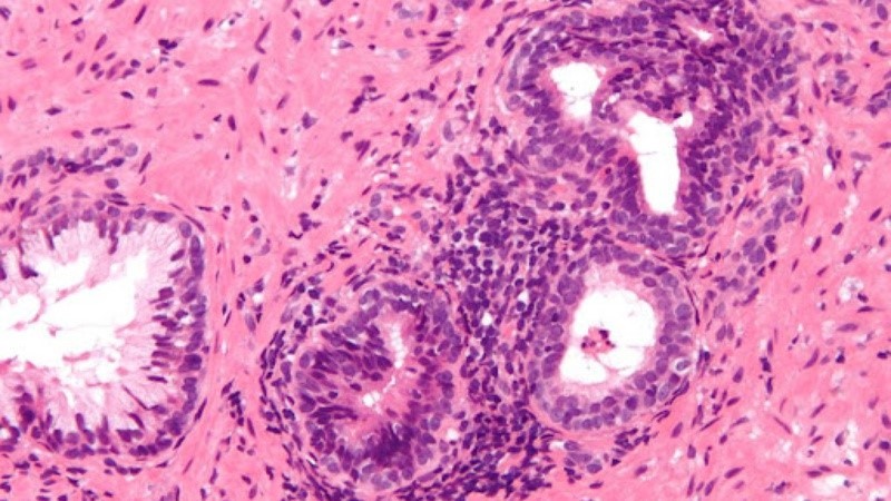 NAD+ Suppressing Inflammatory Consumption | Shaanxi BLOOM Tech Co., Ltd NAD+ Suppressing Inflammatory Consumption | Shaanxi BLOOM Tech Co., Ltd