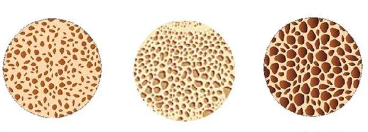 Teriparatide Acetate 500mcg | Shaanxi BLOOM Tech Co., Ltd Teriparatide Acetate 500mcg | Shaanxi BLOOM Tech Co., Ltd