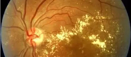 SS-31 drugs | Shaanxi BLOOM Tech Co., Ltd SS-31 drugs | Shaanxi BLOOM Tech Co., Ltd