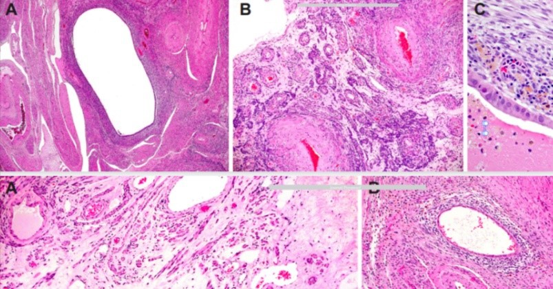Triptorelin Acetate Cost | Shaanxi BLOOM Tech Co., Ltd Triptorelin Acetate Cost | Shaanxi BLOOM Tech Co., Ltd