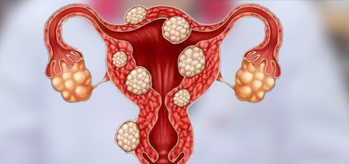 Triptorelin Acetate Buy | Shaanxi BLOOM Tech Co., Ltd Triptorelin Acetate Buy | Shaanxi BLOOM Tech Co., Ltd