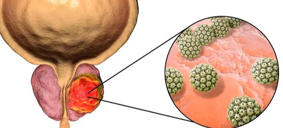 Triptorelin Buy | Shaanxi BLOOM Tech Co., Ltd Triptorelin Buy | Shaanxi BLOOM Tech Co., Ltd