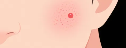 Nonapeptide-1 skin cancer | Shaanxi BLOOM Tech Co., Ltd Nonapeptide-1 skin cancer | Shaanxi BLOOM Tech Co., Ltd